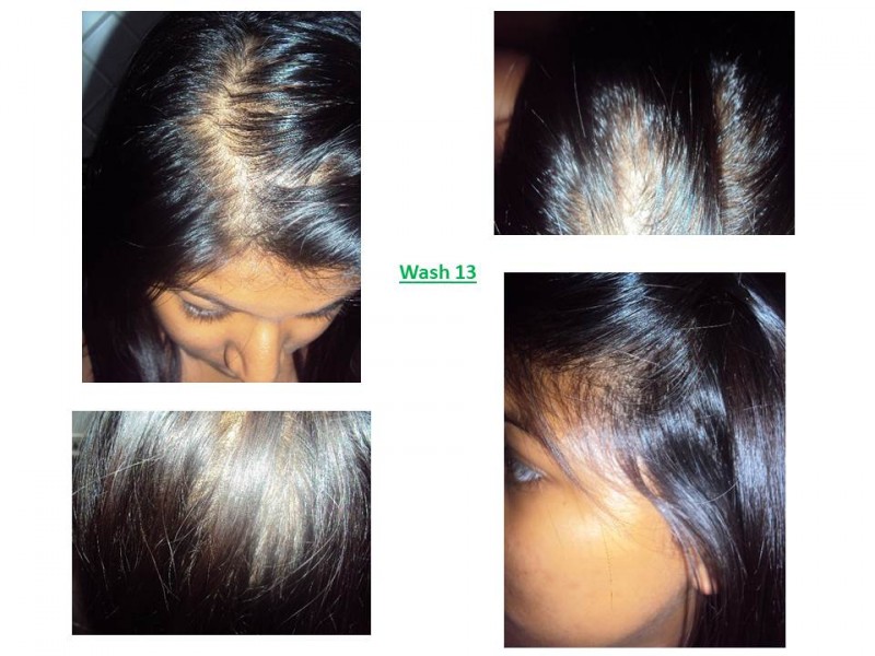 Nioxin Nioxin Hair System Kit 2 Noticeably Thinning Hair Review