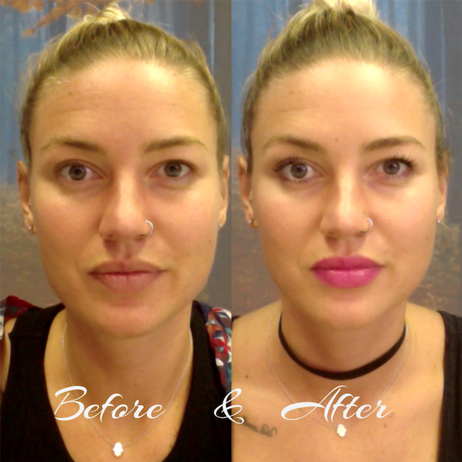 Neutrogena Hydro Boost Before And After