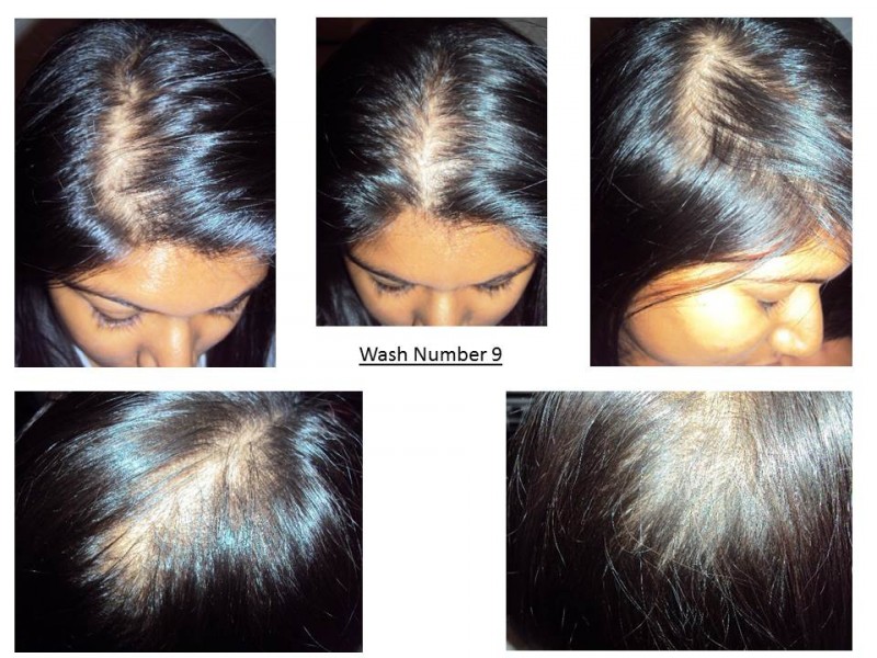 Nioxin Hair Kit 2- Thinning Hair - Bulletin