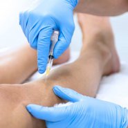 sclerotherapy.jpg