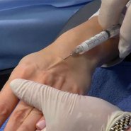 Hand Rejuvination: Injectable fillers
