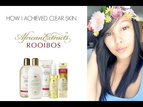 HOW I ACHIEVED CLEAR SKIN WITH AFRICAN EXTRACTS ROOIBOS CLASSIC SKINCARE RANGE