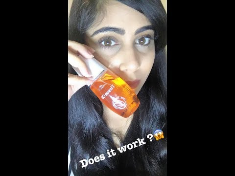Justine Tissue Oil Review|Does it really work???
