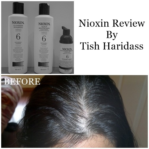 You are currently viewing Nioxin Hair Treatment Kit No. 6